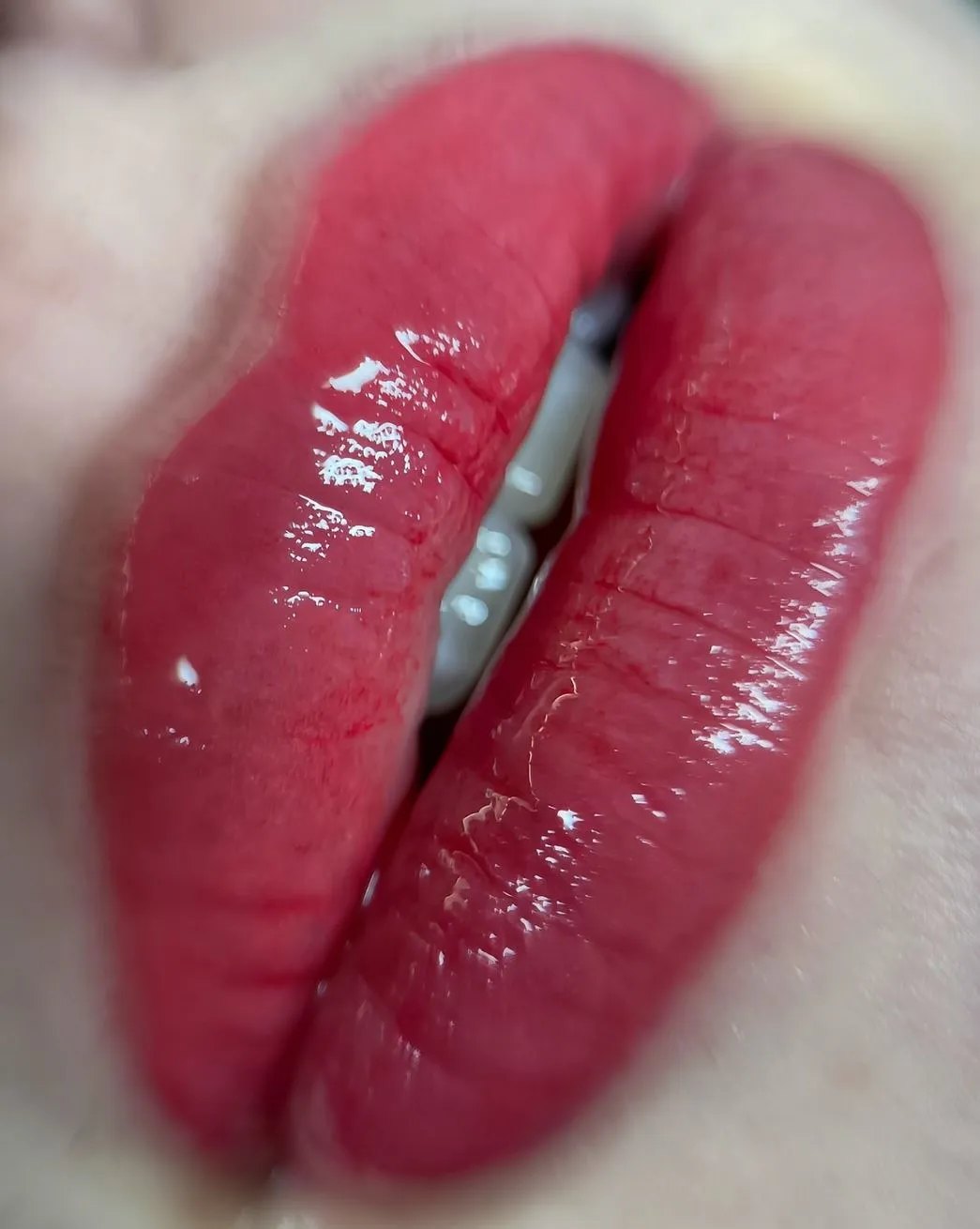 Are You at Risk After Lip Blush