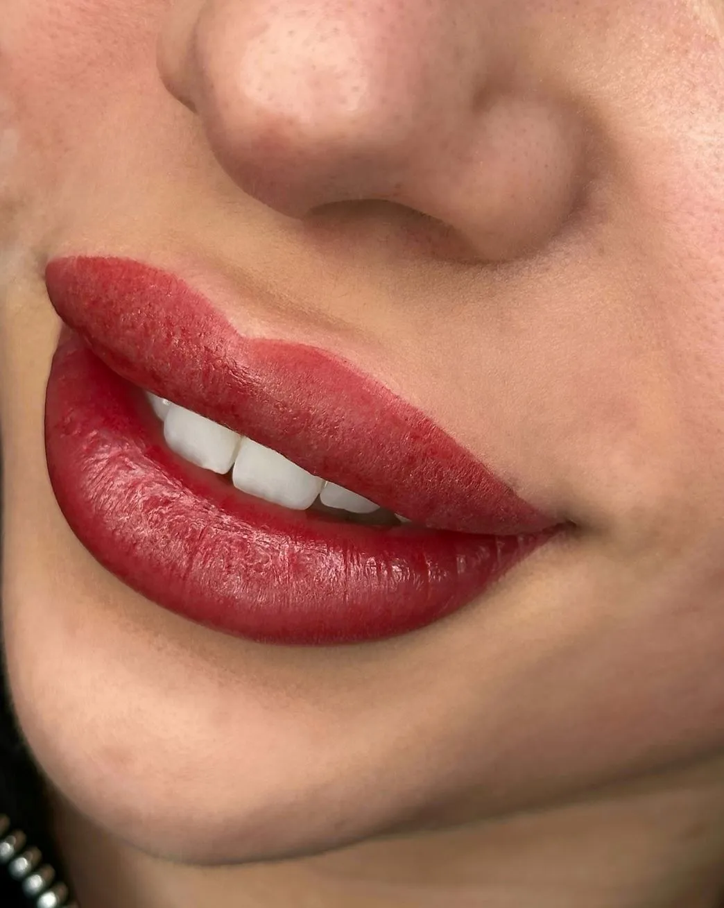 Beforecare for Cold Sore Prevention