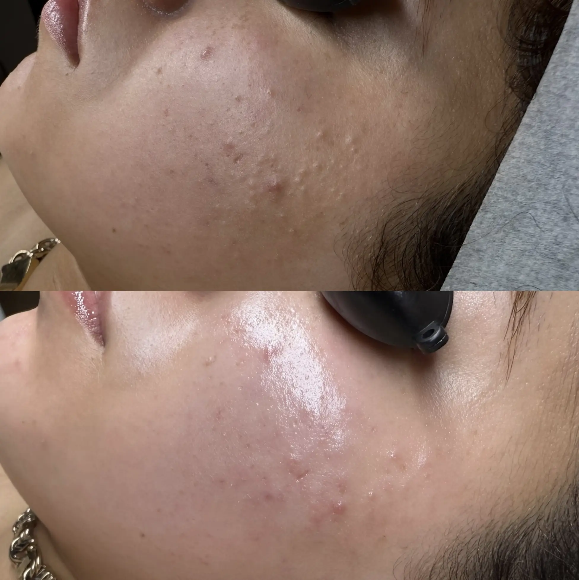 Cosmetic Tattoo Brisbane