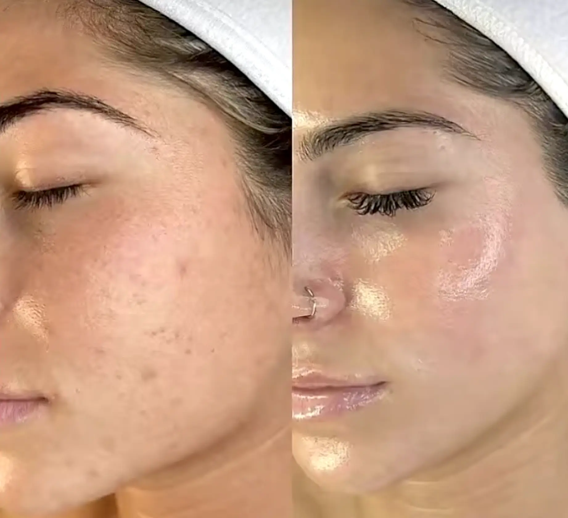 Glowy Skin Over Glam Skin