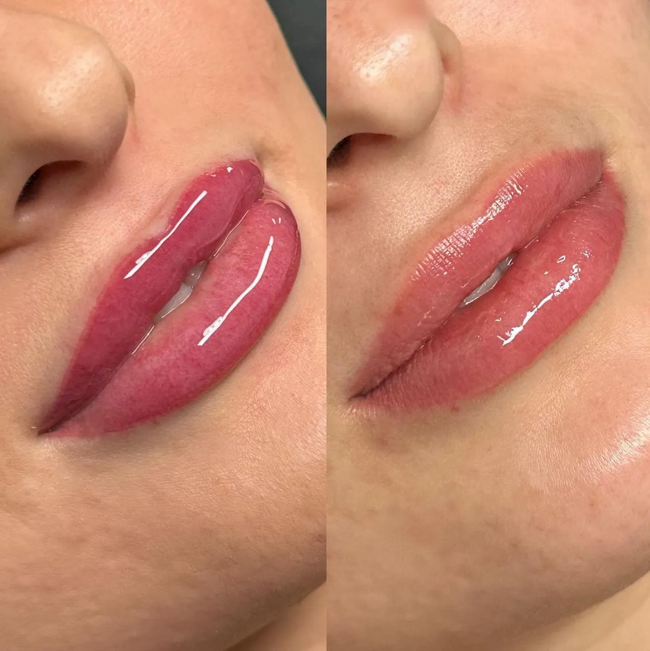 How do you prevent cold sores after a lip tattoo?