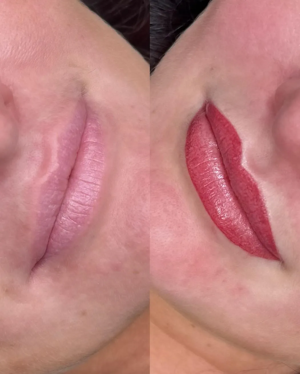 Why Cold Sores Happen After Lip Tattoo