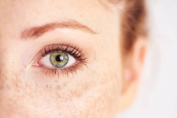 Close-up of a woman's green eye with natural freckles