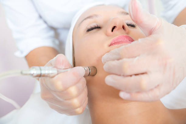 A woman receiving a facial treatment with a microdermabrasion tool in a spa setting.