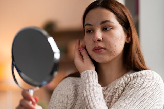 young woman examining her face in a handheld mirror