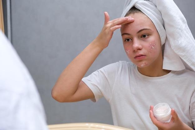 Jason's Developer Corner | Comprehensive Guide to Acne Scar Removal Costs and Treatment Options